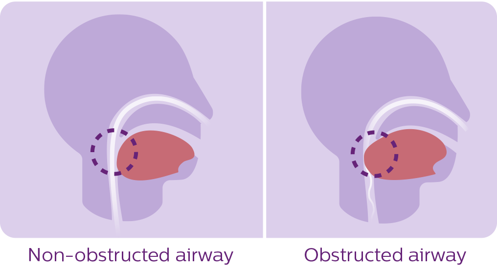 diagram over s&oslash;vnapn&oslash;
